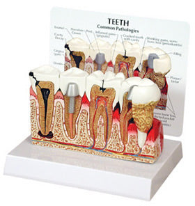 Teeth Budget Model