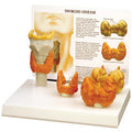 Thyroid Model Set of Four Budget Model