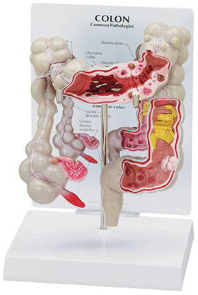 Colon Budget Model