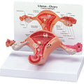Uterus/Ovary Budget Model