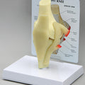 Basic Knee - Budget Model