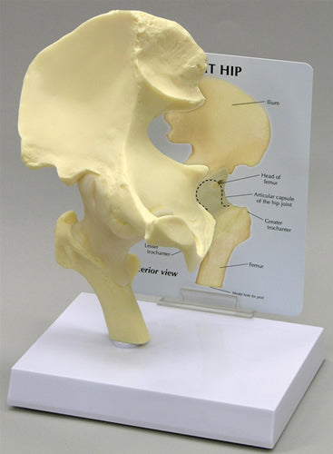Basic Hip - Budget Model