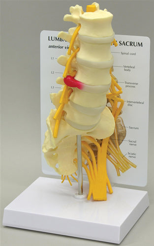 5-Pc. Lumbar Vertebrae with Sacrum - Budget Model