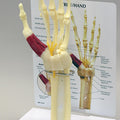 Hand/Wrist - Carpal Tunnel Syndrome - Budget Model