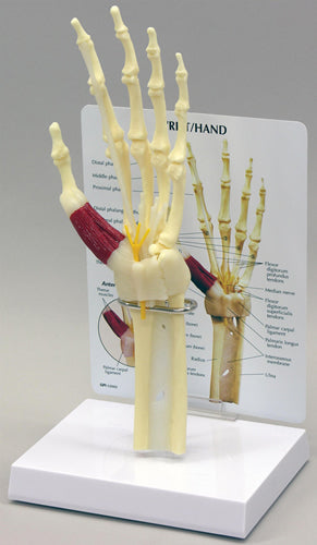 Hand/Wrist - Carpal Tunnel Syndrome - Budget Model