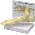 Ankle/Foot - Plantar Fasciitis - Budget Model