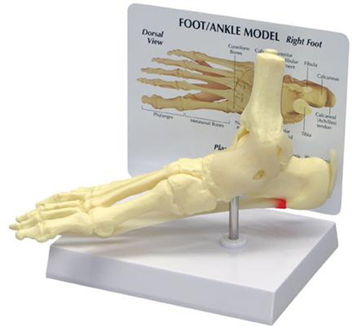 Ankle/Foot - Plantar Fasciitis - Budget Model