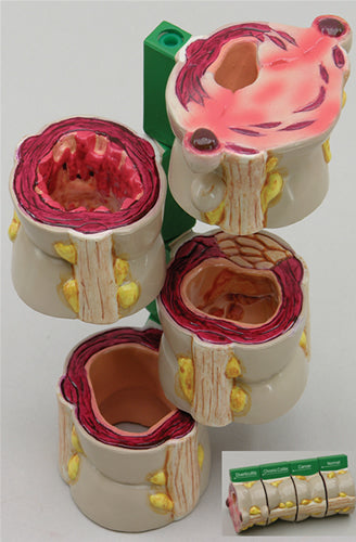 4-Piece Colon - Budget Model
