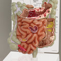 GI Tract - Budget Model