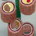 4-Piece Artery - Budget Model