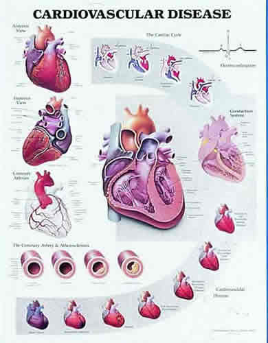 Cardiovascular Disease
