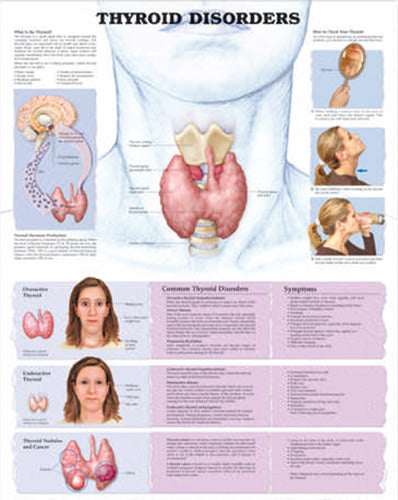 Thyroid Disorders Chart