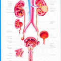 Diseases Of Urinary Tract Chart