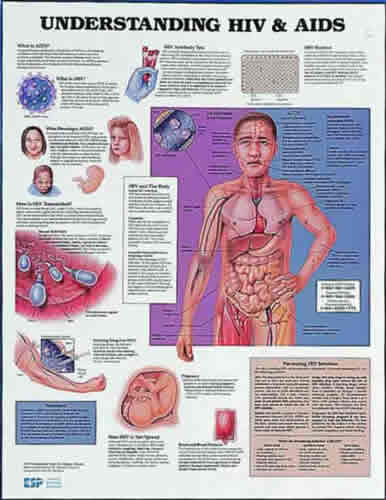 Aids Chart