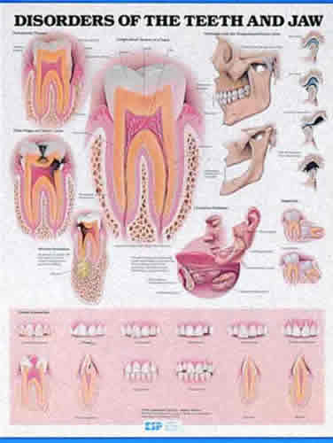 Disorders Of Teeth and Jaw Chart