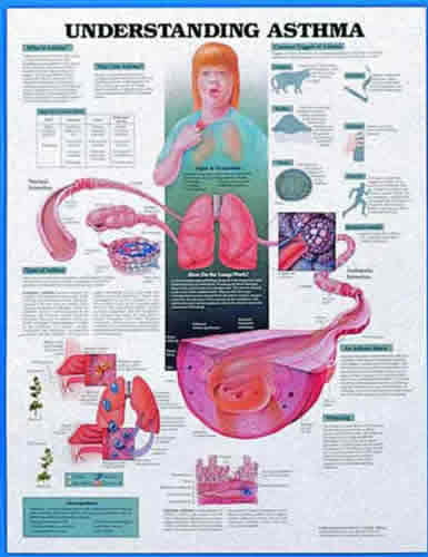 Understanding Asthma