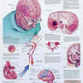 Understanding Strokes