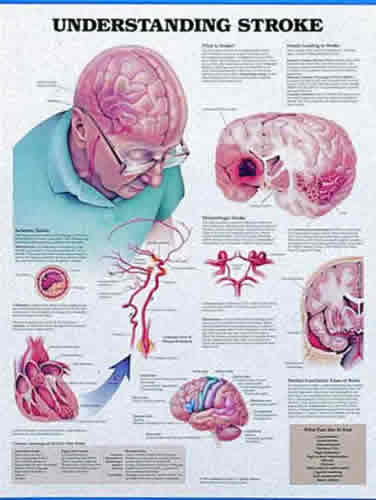 Understanding Strokes