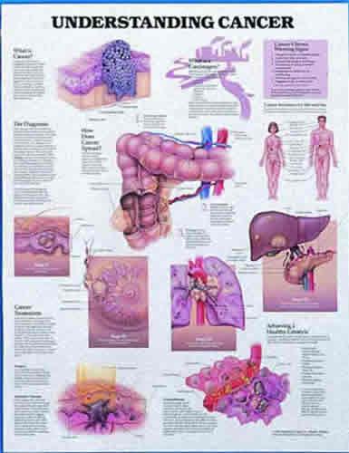 Understanding Cancer