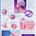 Understand Alzheimers Chart