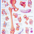 Hip & Knee Inflammation Chart.