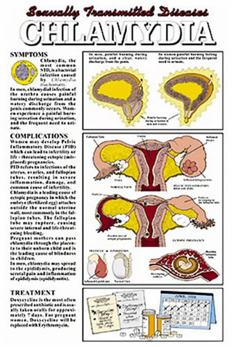 Chlamydia Chart