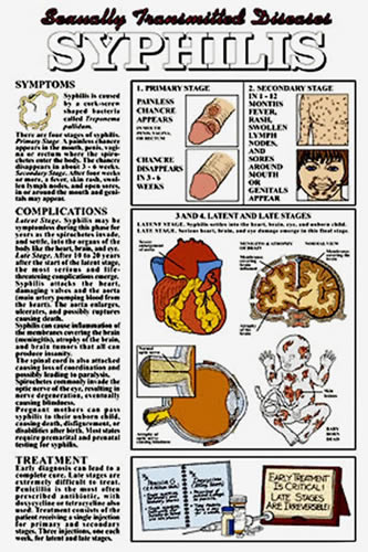 Syphilis Chart