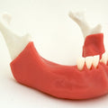 Partially Endentulous Mandible with Tissue