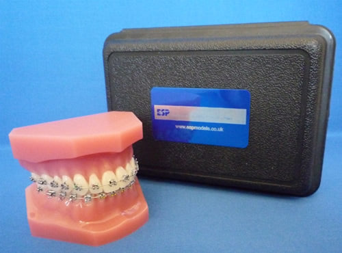 Orthodontic Maxilla & Mandible with Fixed Braces