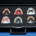 Implant Practice Building Kit