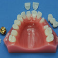 Cosmetic Dentistry Maxilla 6-Part