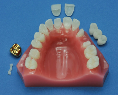 Cosmetic Dentistry Maxilla 6-Part