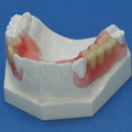 Crown & Bridge Combination Maxilla