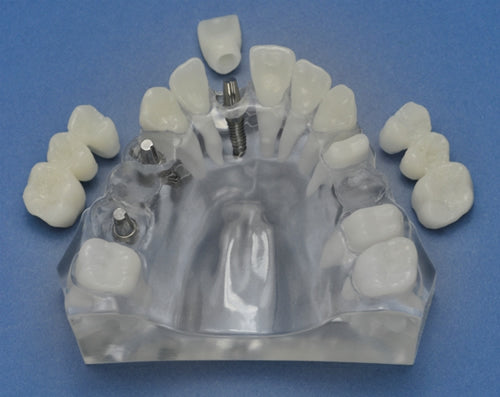Hybrid Mandible