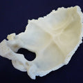 Occipital