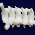 Cervical - Vertebra