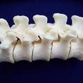 Lumbar - Vertebra