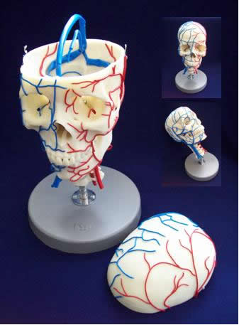 Vascular Skull