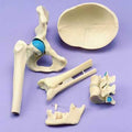 Joints Set Of 5