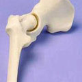 Hip - Miniature Joint