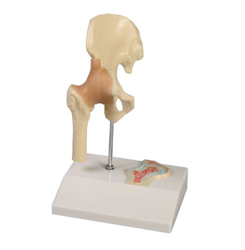 Hip Joint, 1/2 Life Size with Cross Section