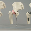 Hip Implant Model - Set of 3 Joints