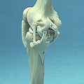 Knee Joint Ligamented