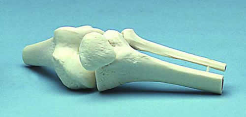 Knee Joint Movable