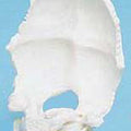 Movable Occipital Unmounted