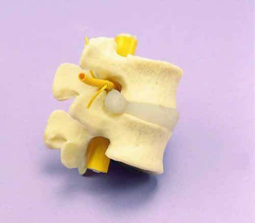 Two Vertebrae