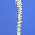 Flexible Spine, Medical, With Pelvis