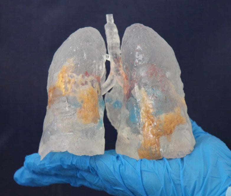 3D Printed COVID-19 Lungs Mini Size