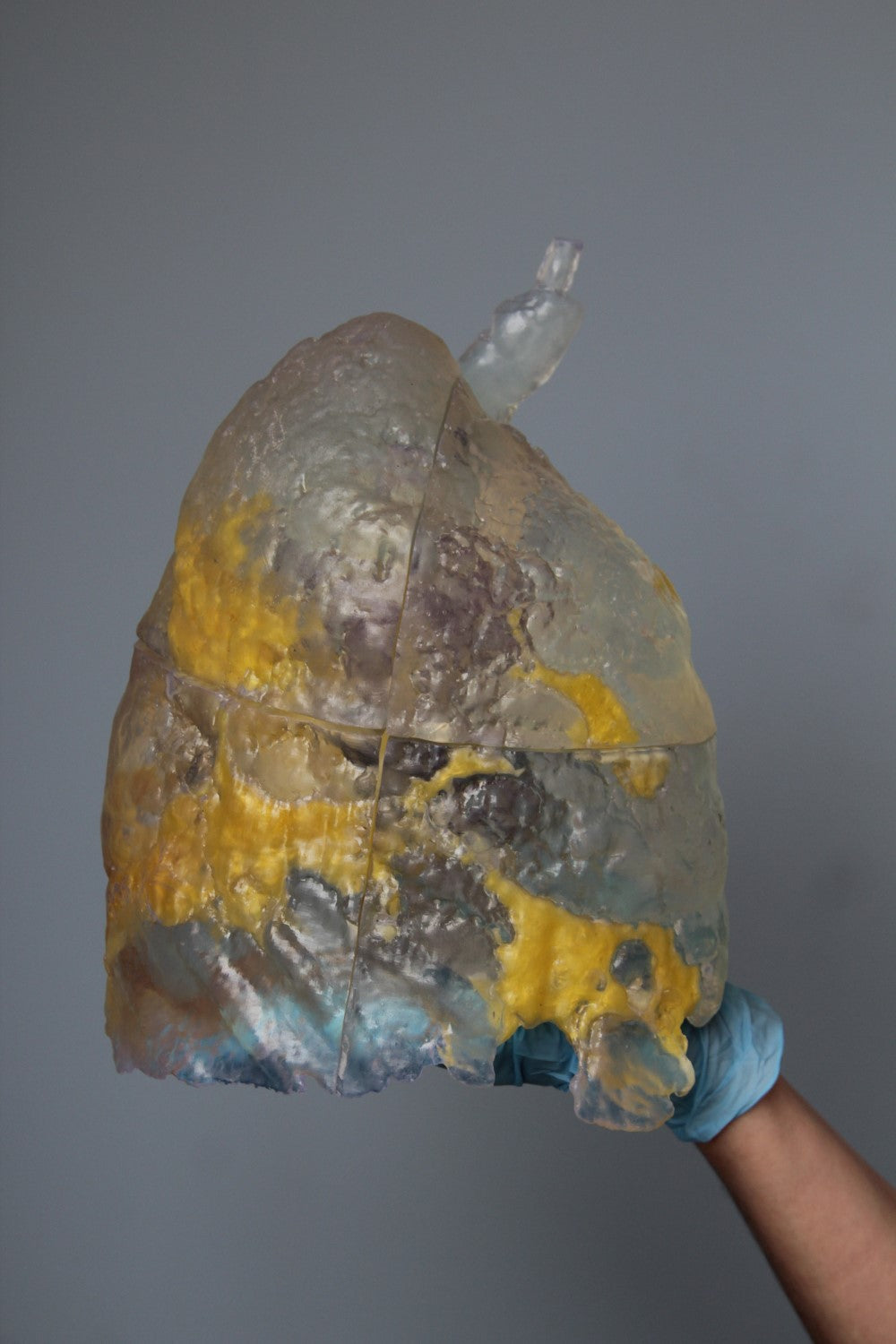 3D Printed COVID-19 Lungs 70% Size