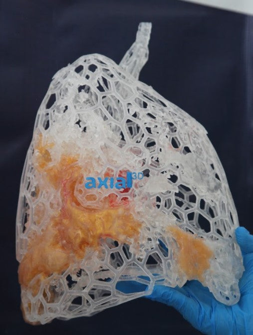 3D Printed COVID-19 Lungs Full Size Mesh